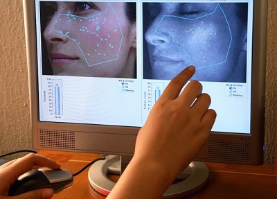 компьютерная диагностика кожи лица